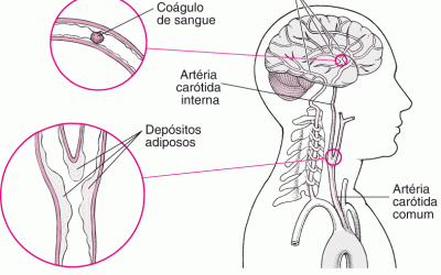 Revisão da Anatomia e Fisiologia do Sistema Nervoso Central e Acidente Vascular Cerebral